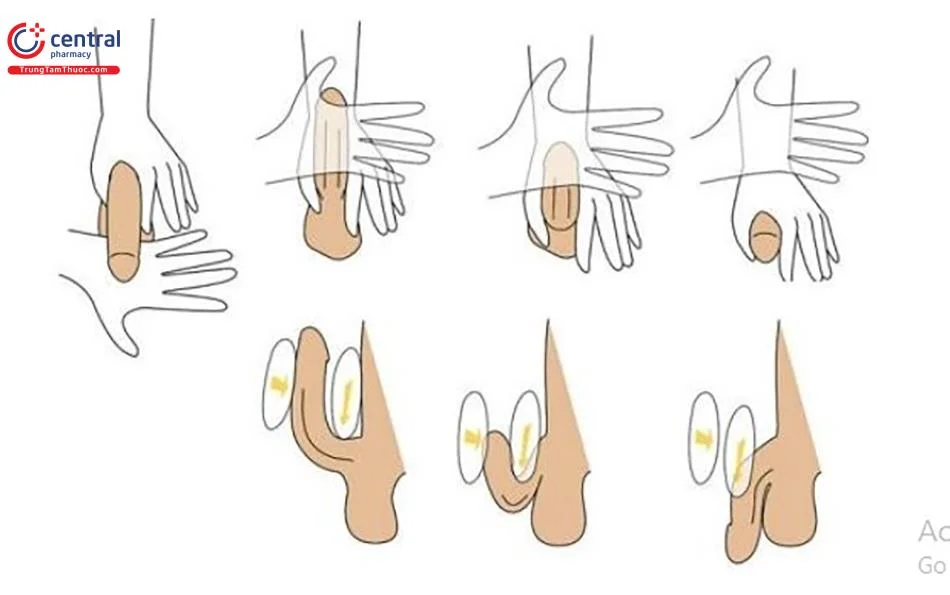Bộ ảnh thuốc tăng kích thước cậu nhỏ, tấm 16